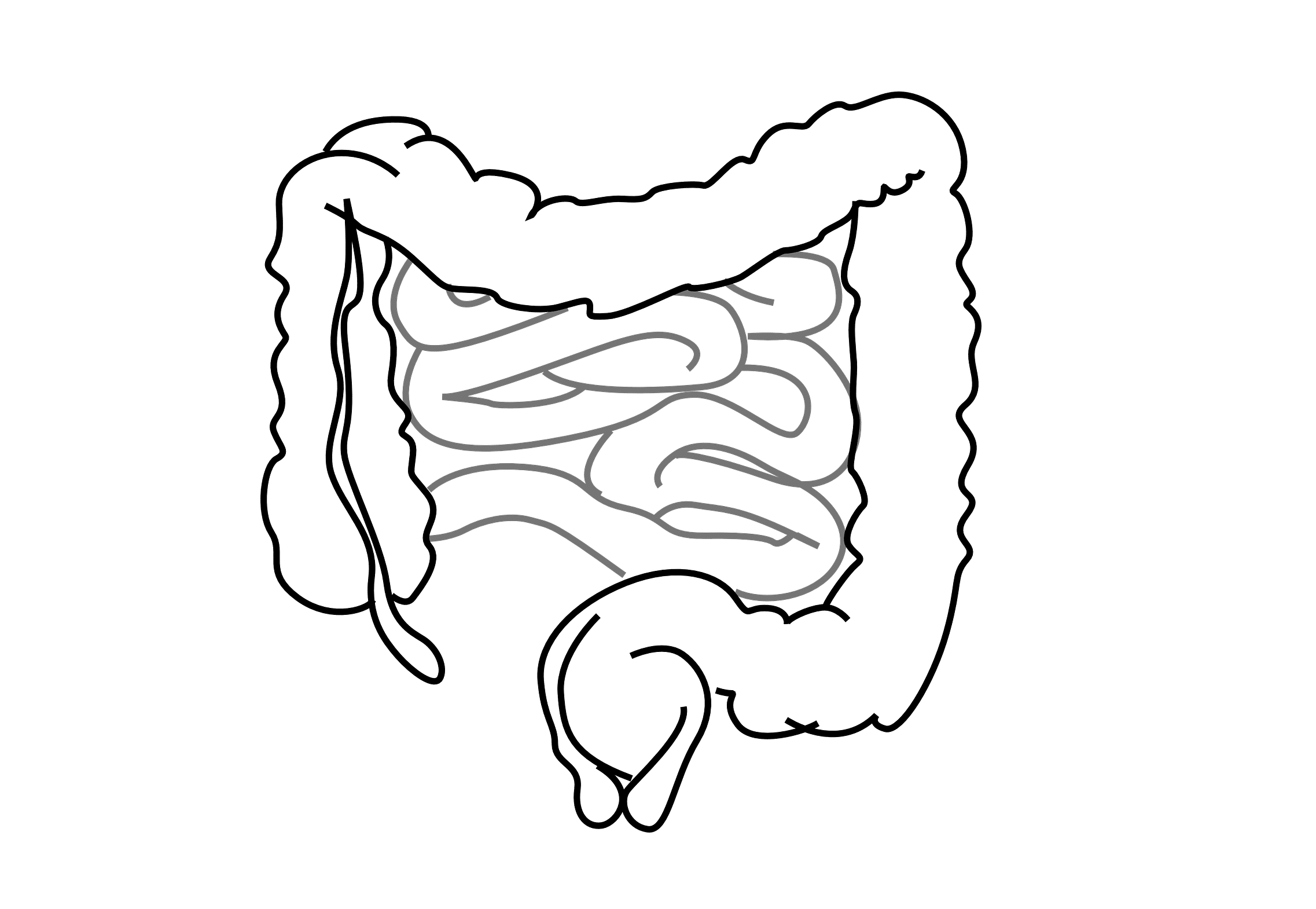 Črevo a mozog #9 Skrátené črevo a apendix