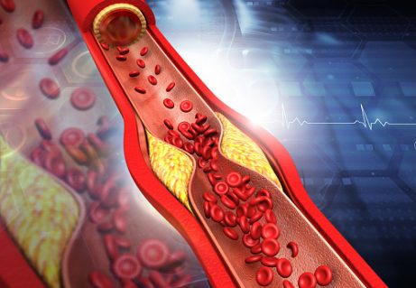 Hormóny #3 Cholesterol a jeho rozdielny objem, hmotnosť a Energia