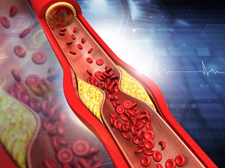 Hormóny #3 Cholesterol a jeho rozdielny objem, hmotnosť a Energia