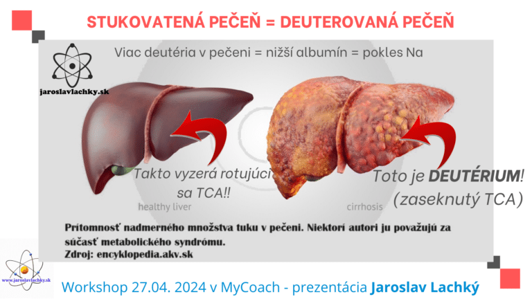 Workshop 27.04. BIO-MAGNETIZMUS by Jaroslav Lachký ako vyzerá stukovatená pečeň naozaj a deutérium v nej