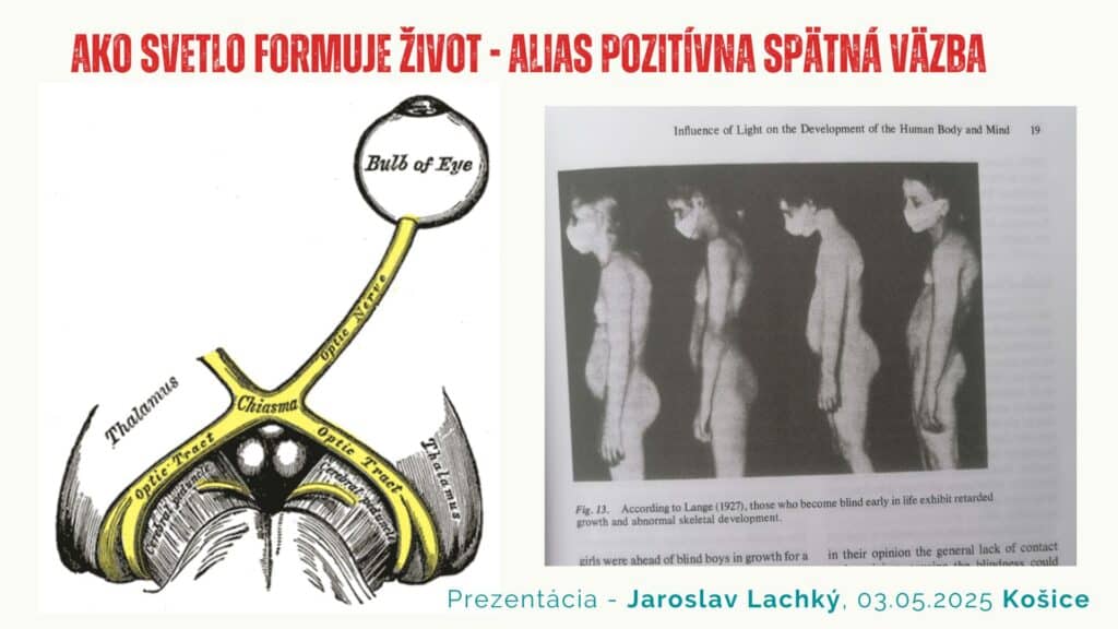 SCN, suprachiasmatické jadro, optický chiasmus a&nbsp;Vitalfest by Jaroslav Lachký